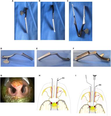 Application of binasal speculum in endoscopic endonasal surgery for lesions in sellar region